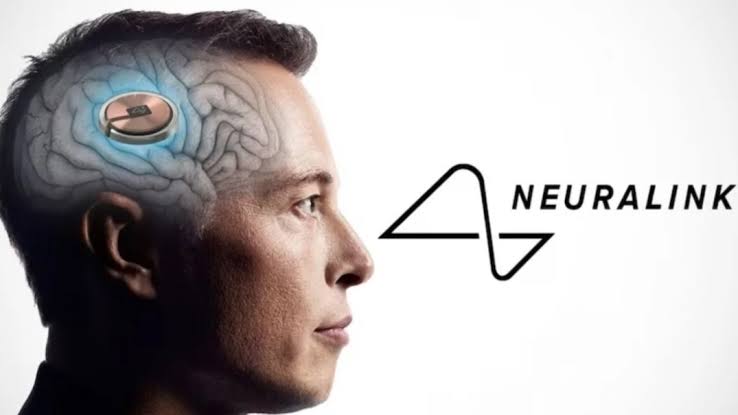Neuralink, Milik Elon Musk, Sukses Menanamkan Chip Pertama ke Manusia