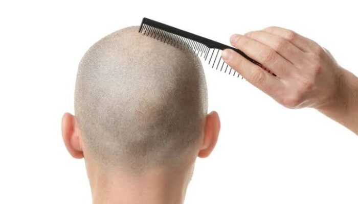 Arti Mimpi Rambut Istri Dipotong Pendek, Pertanda Perubahan Emosi atau Hubungan?